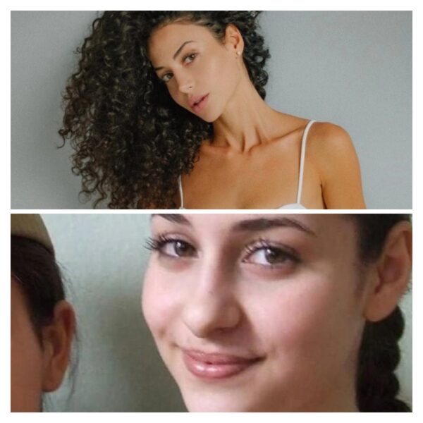 Крупный нос и «восточная» внешность: как Зепюр Брутян изменила себя до неузнаваемости с помощью пластических операций