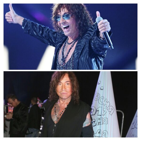 Ножи американских хирургов: как Валерий Леонтьев лишился сна из-за неудачной пластики и теперь не может закрыть глаза