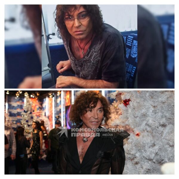 Ножи американских хирургов: как Валерий Леонтьев лишился сна из-за неудачной пластики и теперь не может закрыть глаза