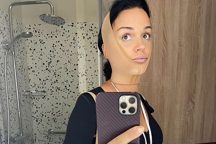 "Лисьи глазки" за 250 тысяч: Боня "как Джексон", а Бабкина «опошлила» лицо в 76 лет