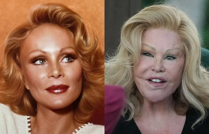 «Хотелось провалиться сквозь землю»: как звезды за 60 и 80 лет изменили себя до неузнаваемости, а одна потеряла миллиарды