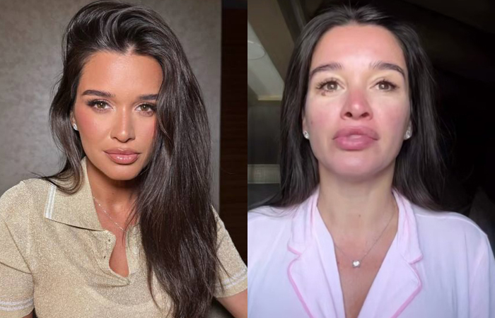 Иллюзия совершенства: Как 43-летняя Бородина выглядит на 25, а 70-летняя Долина «не стареет» в кадре, но что скрывают фильтры