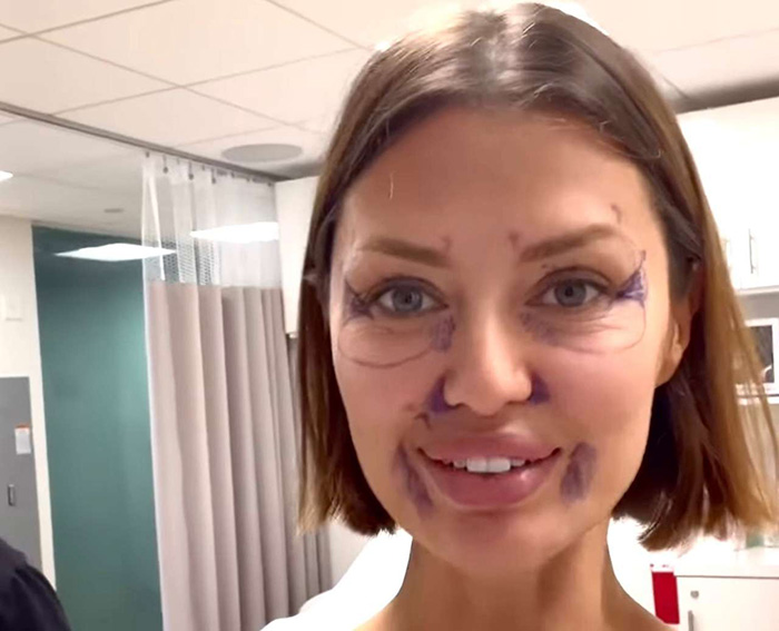 "Лисьи глазки" за 250 тысяч: Боня "как Джексон", а Бабкина «опошлила» лицо в 76 лет