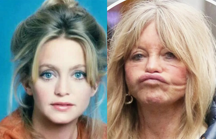 «Хотелось провалиться сквозь землю»: как звезды за 60 и 80 лет изменили себя до неузнаваемости, а одна потеряла миллиарды