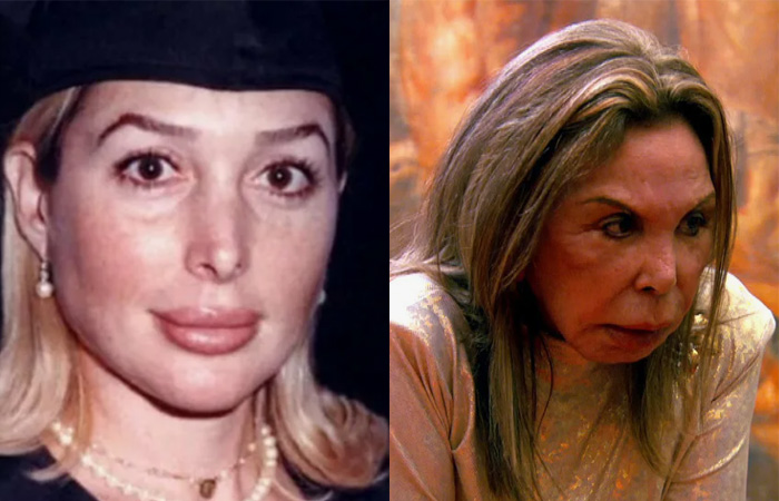 «Хотелось провалиться сквозь землю»: как звезды за 60 и 80 лет изменили себя до неузнаваемости, а одна потеряла миллиарды