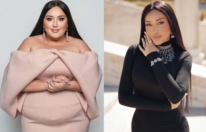 Минус 100 килограммов: как 52-летний Дужников и другие звёзды решились на операцию ради здоровья