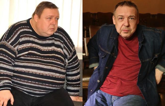 Минус 100 килограммов: как 52-летний Дужников и другие звёзды решились на операцию ради здоровья