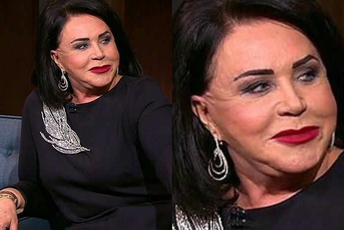 "Лисьи глазки" за 250 тысяч: Боня "как Джексон", а Бабкина «опошлила» лицо в 76 лет