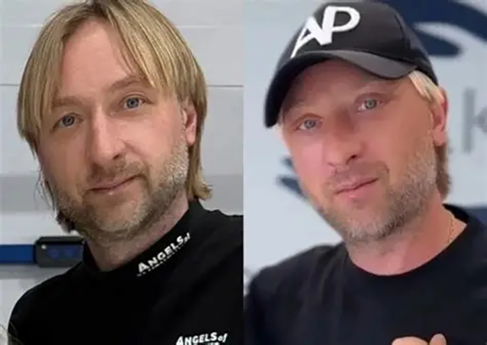 "Лисьи глазки" за 250 тысяч: Боня "как Джексон", а Бабкина «опошлила» лицо в 76 лет