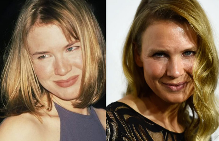 «Хотелось провалиться сквозь землю»: как звезды за 60 и 80 лет изменили себя до неузнаваемости, а одна потеряла миллиарды