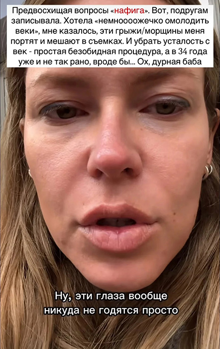 "Лисьи глазки" за 250 тысяч: Боня "как Джексон", а Бабкина «опошлила» лицо в 76 лет