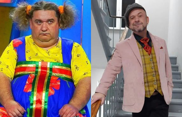 Минус 100 килограммов: как 52-летний Дужников и другие звёзды решились на операцию ради здоровья