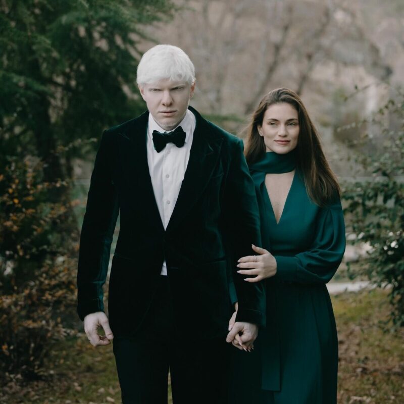 Екатерина Хведелидзе с сыновьями Берой и Цотне, родившимися с альбинизмом.