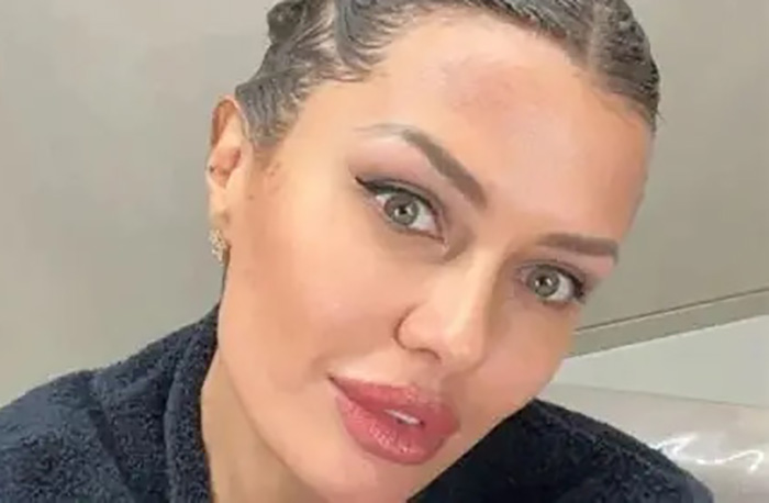 "Лисьи глазки" за 250 тысяч: Боня "как Джексон", а Бабкина «опошлила» лицо в 76 лет