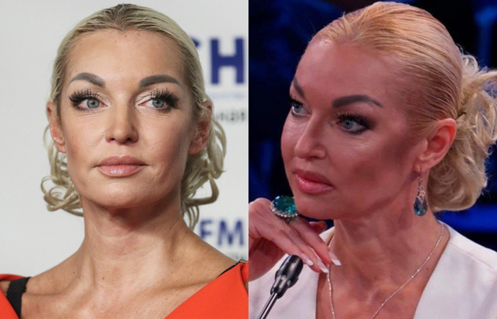 Иллюзия совершенства: Как 43-летняя Бородина выглядит на 25, а 70-летняя Долина «не стареет» в кадре, но что скрывают фильтры