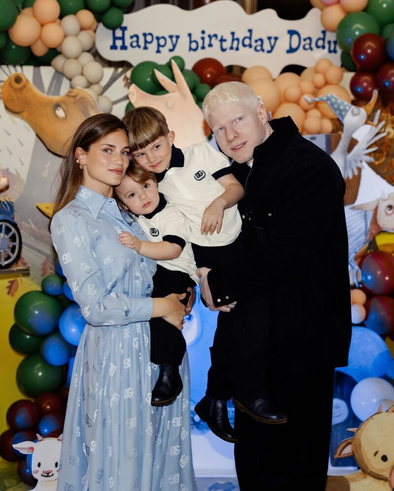 Бера в детстве: особенная внешность привлекала внимание с юных лет.