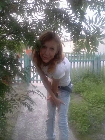 Первые результаты пластических операций изменили её облик.