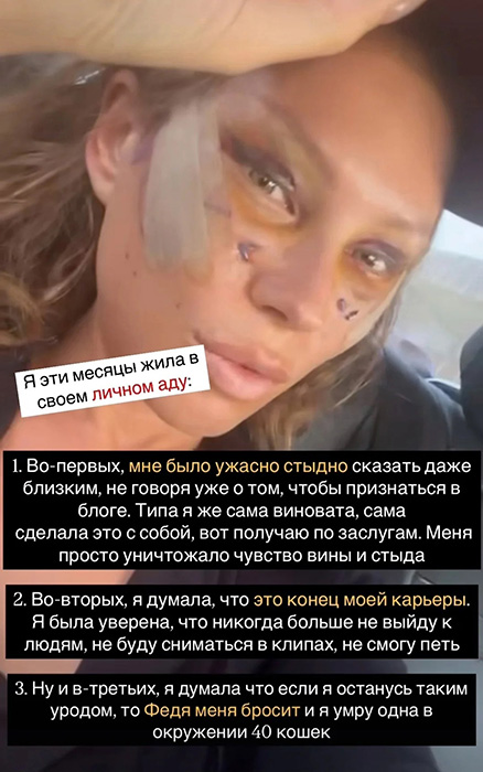 "Лисьи глазки" за 250 тысяч: Боня "как Джексон", а Бабкина «опошлила» лицо в 76 лет