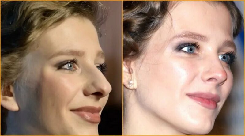 Лиза Арзамасова до заметных косметологических процедур, с природными чертами лица.