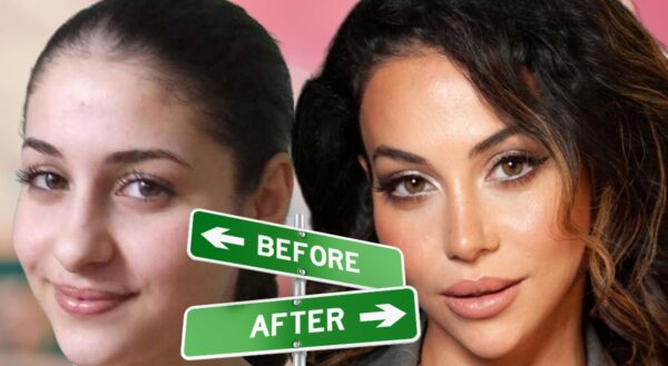 Крупный нос и «восточная» внешность: как Зепюр Брутян изменила себя до неузнаваемости с помощью пластических операций