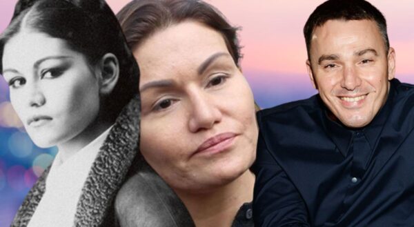 «Выглядит старше мужа»: скандал вокруг пластики жены «Иванушки» и почему её лицо изменилось до неузнаваемости