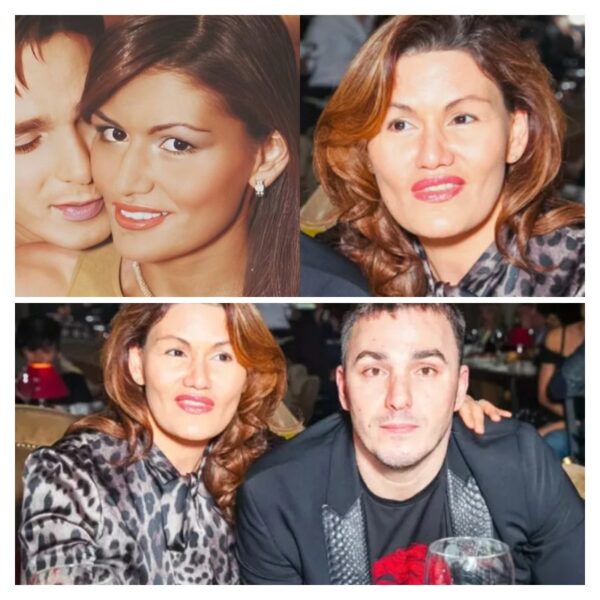 «Выглядит старше мужа»: скандал вокруг пластики жены «Иванушки» и почему её лицо изменилось до неузнаваемости