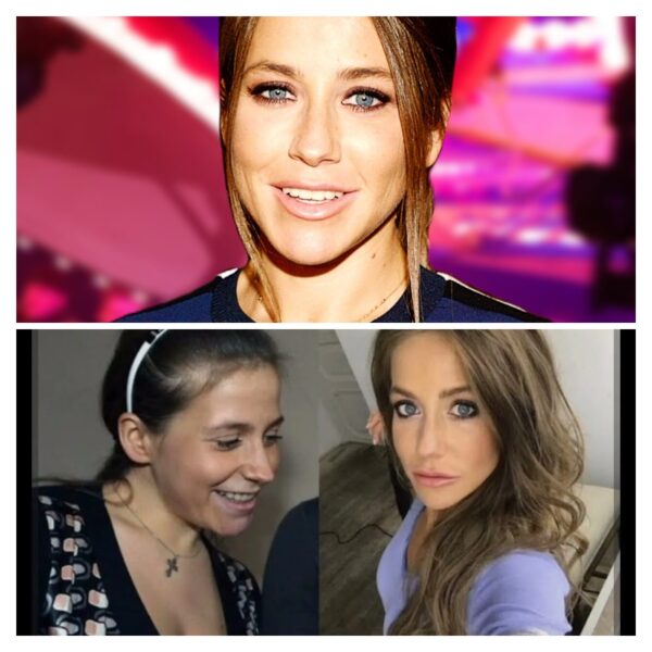 Плата за красоту: как пластическая операция Юлии Барановской едва не убила её и привела на операционный стол