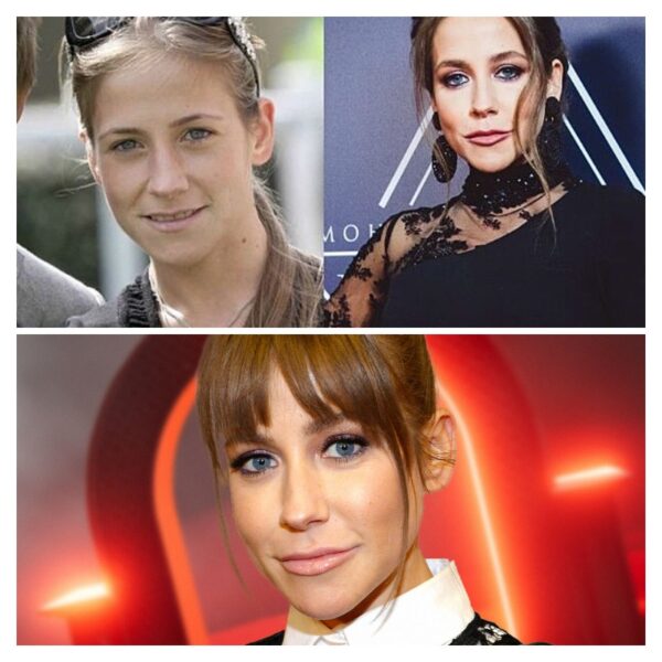 Плата за красоту: как пластическая операция Юлии Барановской едва не убила её и привела на операционный стол