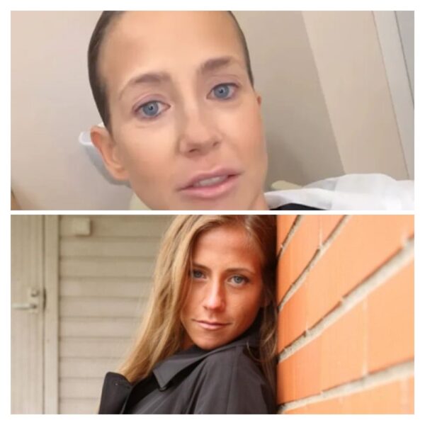 Плата за красоту: как пластическая операция Юлии Барановской едва не убила её и привела на операционный стол