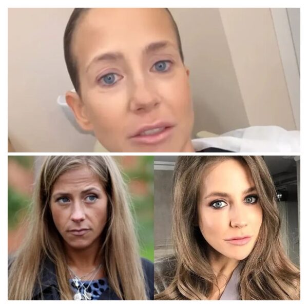 Плата за красоту: как пластическая операция Юлии Барановской едва не убила её и привела на операционный стол