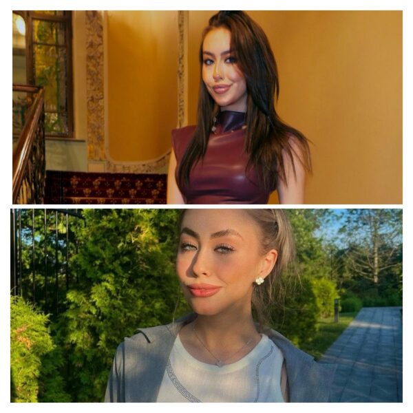 Губы Джоли, комки Биша и лисьи глазки: пластические хирурги разоблачили внучку Маслякова, а она все отрицает