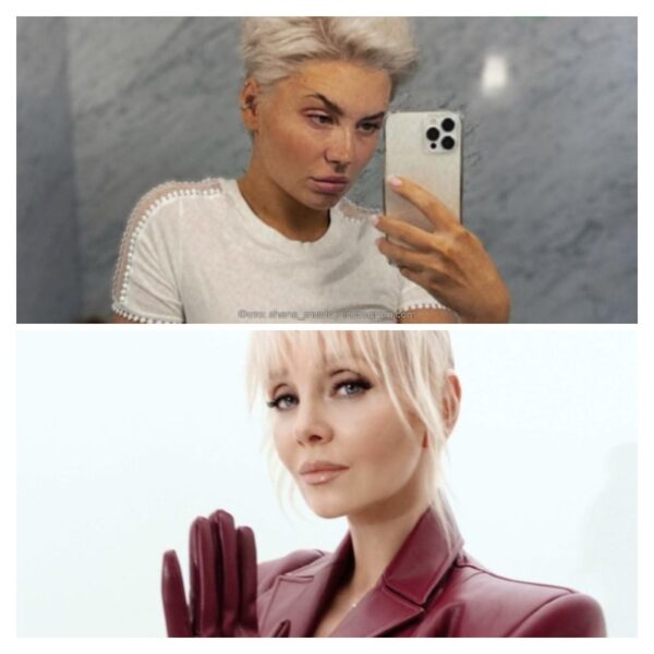 Два года боли, потеря слуха и антидепрессанты: стало известно о страшной болезни дочери Валерии