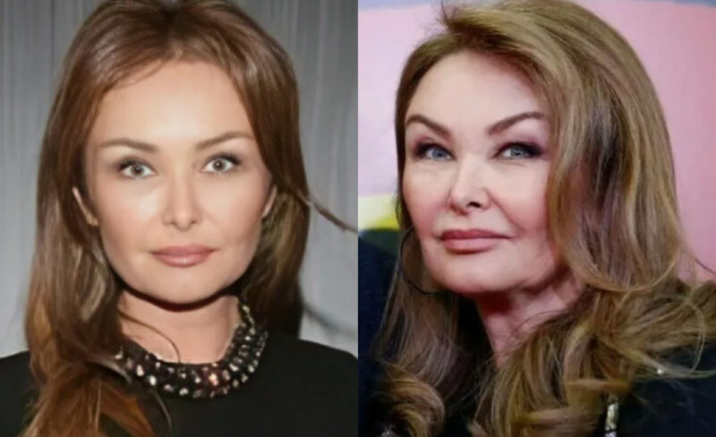 Елена Изаксон: сравнение до и после пластики
