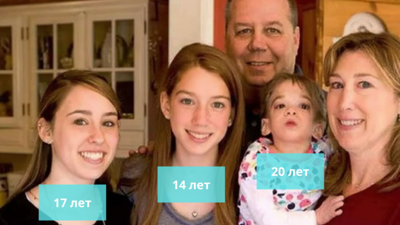 Младенец на 20 лет: как история Брук Гринберг перевернула представления о старении