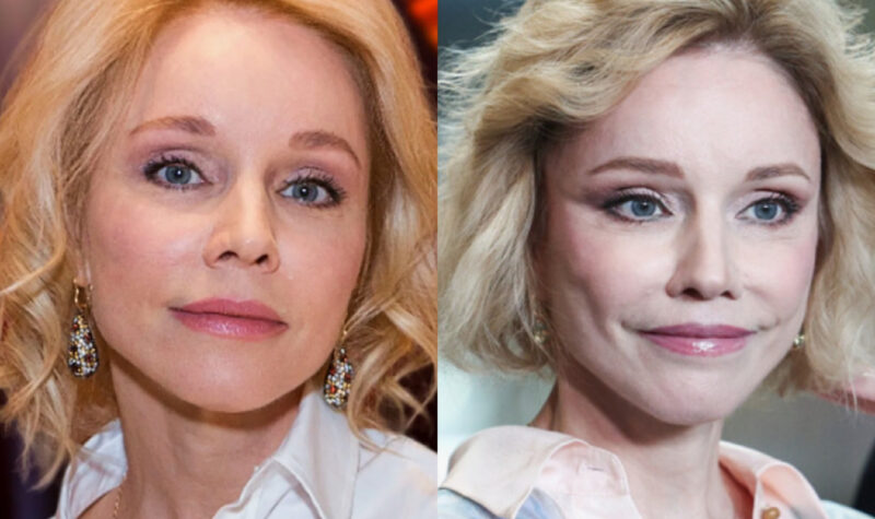 Марина Зудина: результаты пластических операций