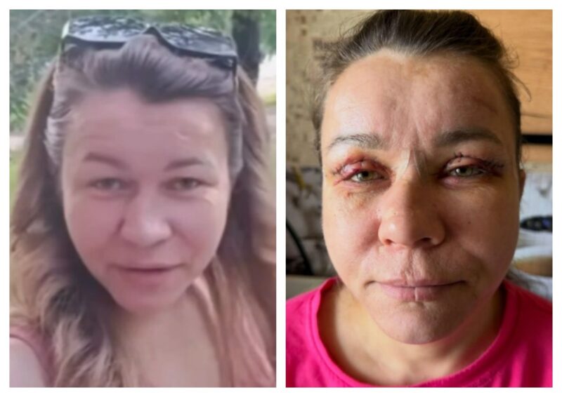 Сравнение: Иришка Чики-Пики до и после хирургического вмешательства.