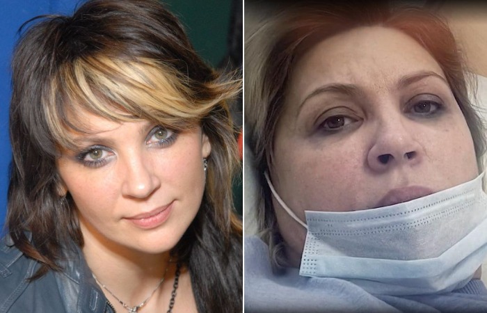 Ая из «Города 312»: как звезда пережила инсульт и вернулась к жизни