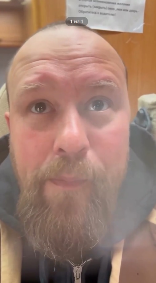 Кирилл Плетнев сегодня: заметные изменения во внешности артиста.