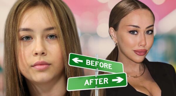 Губы Джоли, комки Биша и лисьи глазки: пластические хирурги разоблачили внучку Маслякова, а она все отрицает