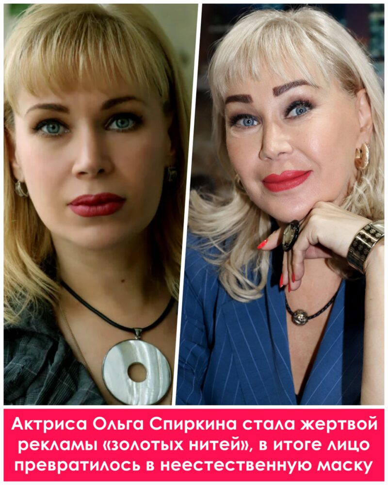 Цена совершенства: как пластика изменила жизни российских звезд