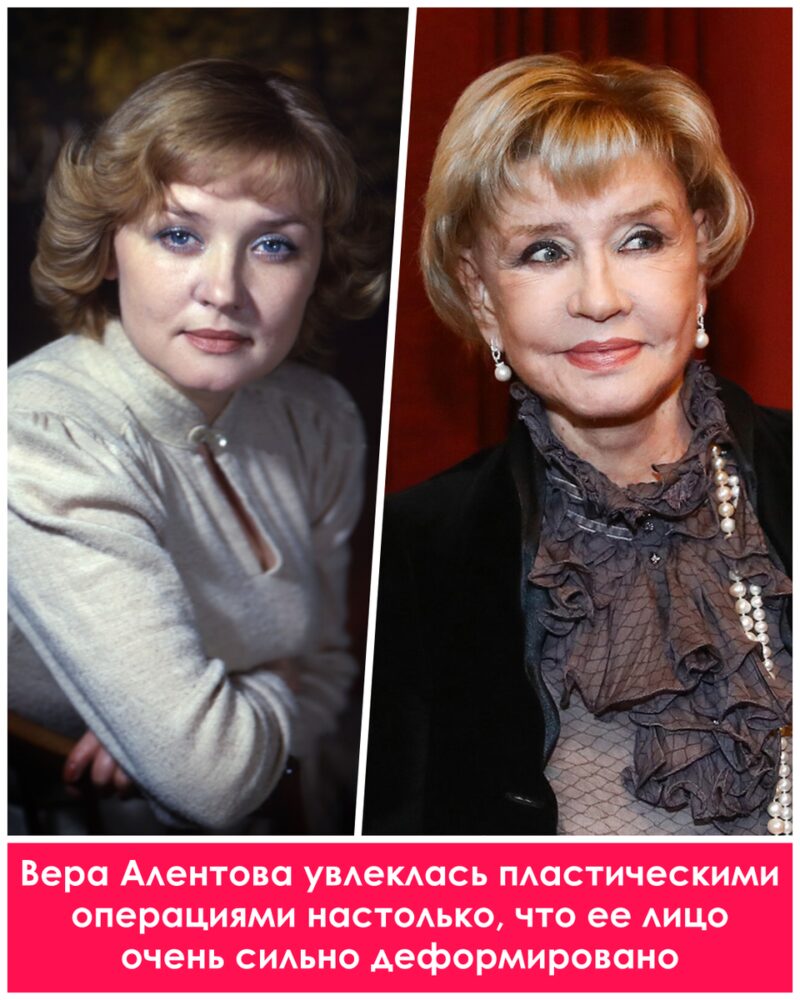 Цена совершенства: как пластика изменила жизни российских звезд