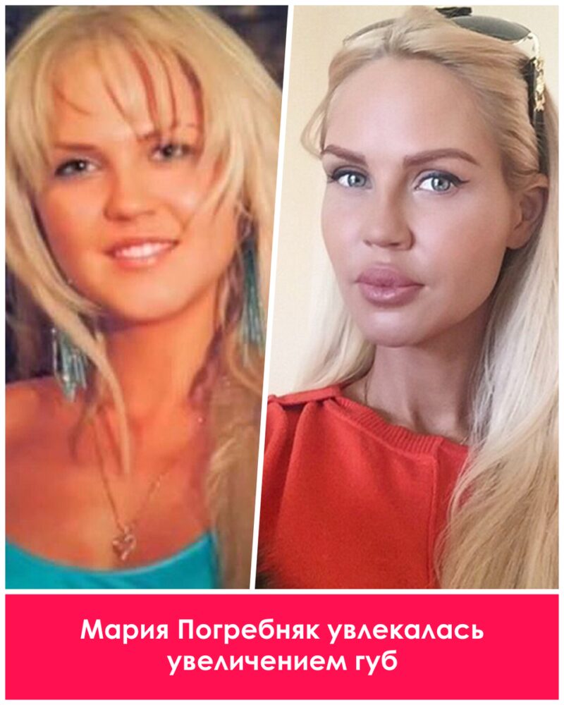 Цена совершенства: как пластика изменила жизни российских звезд