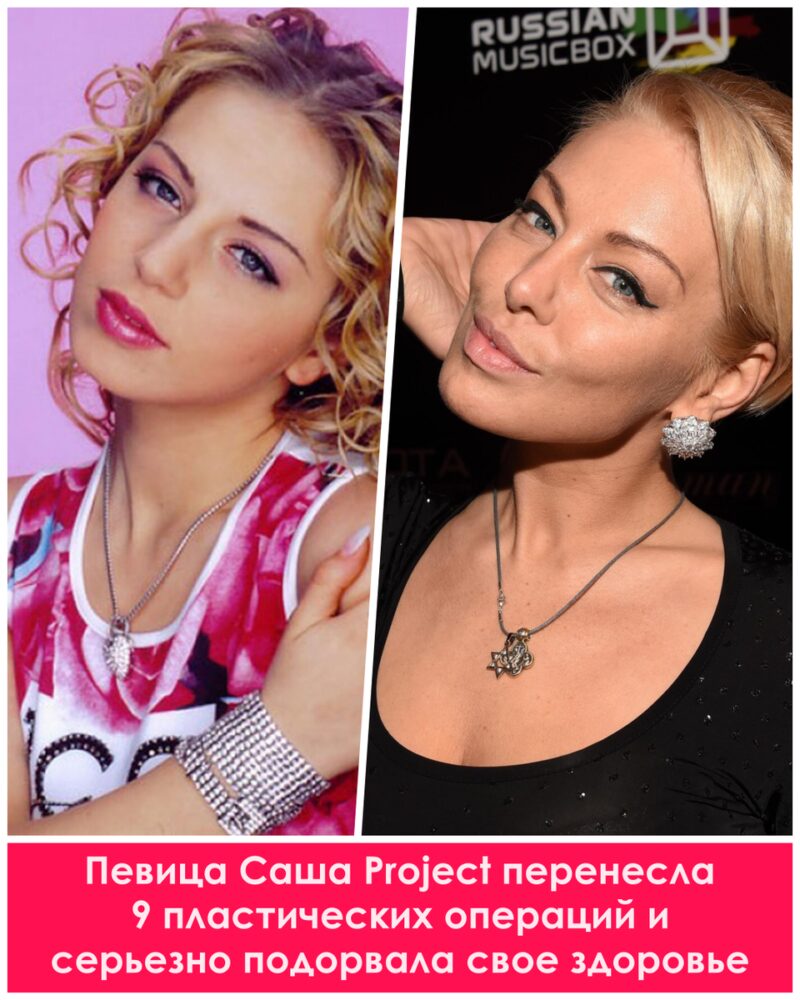 Цена совершенства: как пластика изменила жизни российских звезд