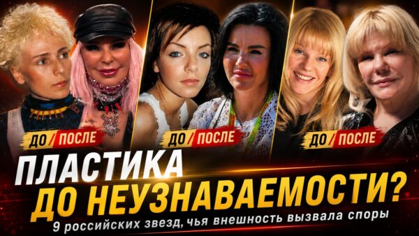 Утраченная индивидуальность: как изменились 9 российских знаменитостей после неудачных бьюти-процедур