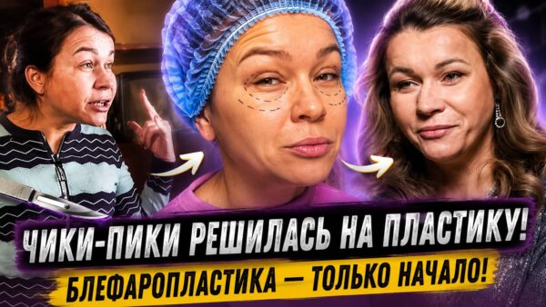 Сначала веки, потом улыбка: как Иришка Чики-Пики решила изменить свою внешность