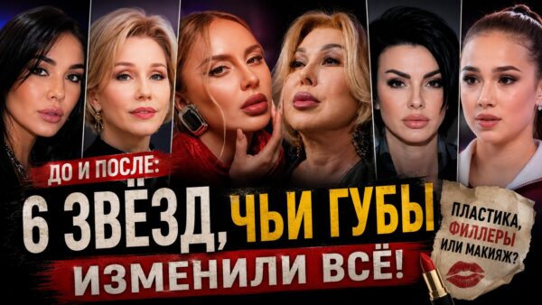 6 звёзд, чьи эксперименты с губами разделили поклонников на два лагеря