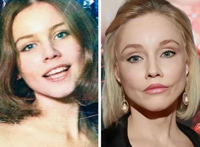 Актриса со временем увлеклась услугами пластических хирургов