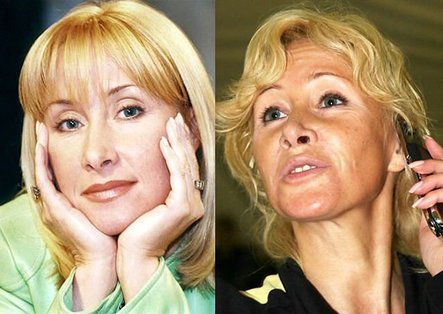 8 историй преображений российских звёзд: от вынужденных операций до громких судебных исков