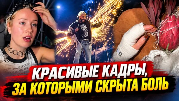 ANNA ASTI выплюнула осколки зубов, Киркоров загорелся, JONY спасали врачи: 6 звёзд, которые всё равно продолжили концерт