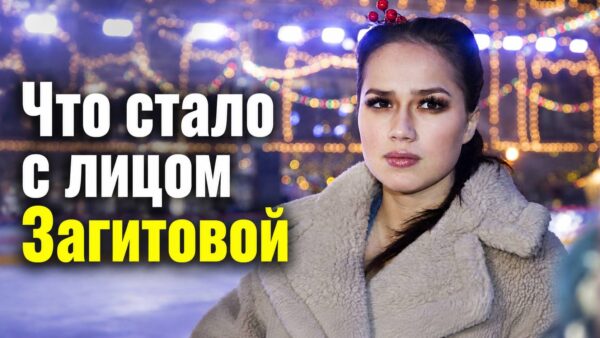 Ничего живого не осталось: что опять стало с лицом Загитовой